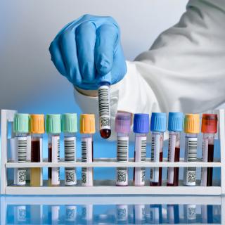 INFORMACJA DLA RODZICÓW – MONONUKLEOZA